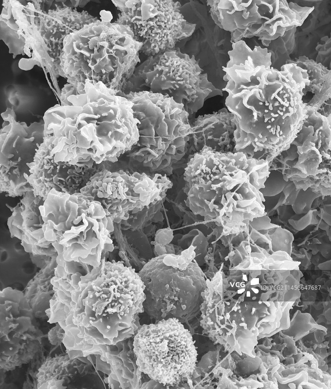 组织巨噬细胞，扫描电镜图片素材