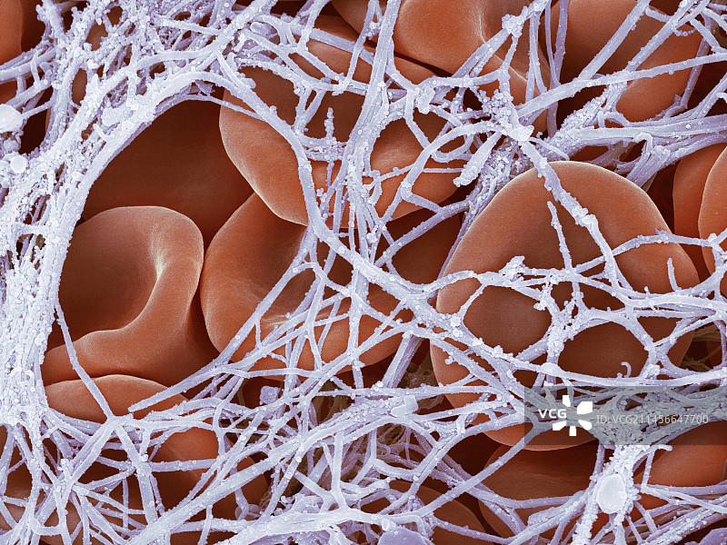 血栓扫描电镜图片素材