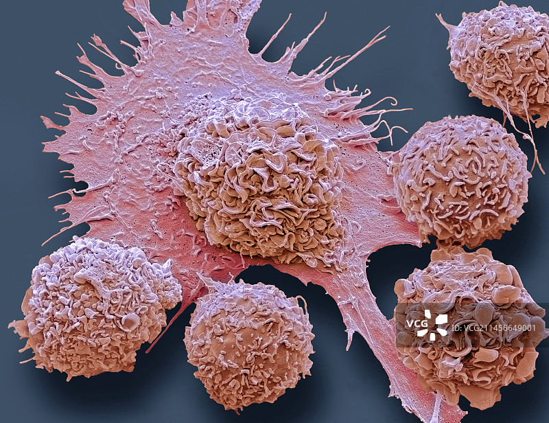 巨噬细胞，扫描电镜图片素材