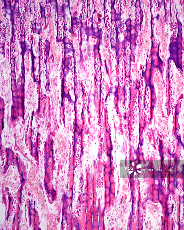 生长板，光学显微照片图片素材