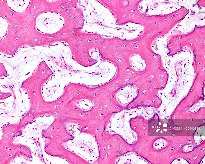 膜内骨化，光学显微照片图片素材