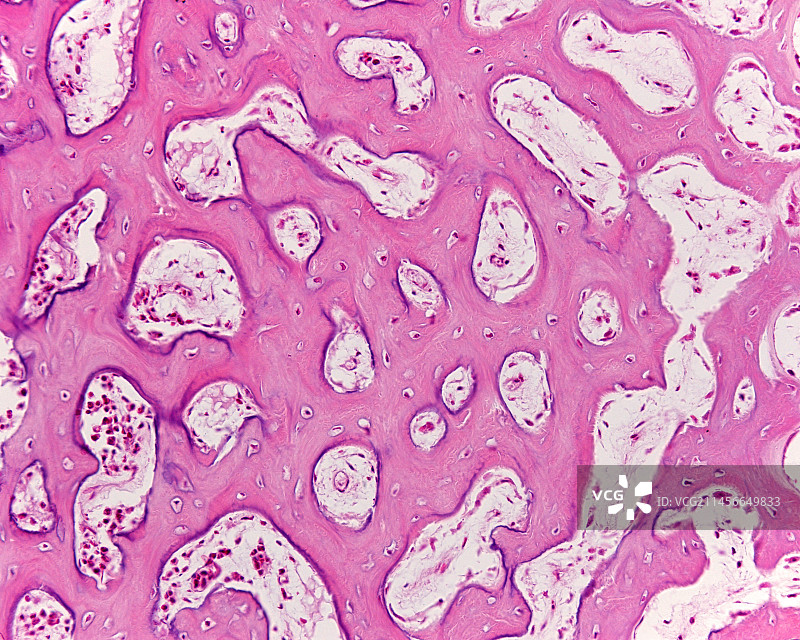 膜内骨化，光学显微照片图片素材