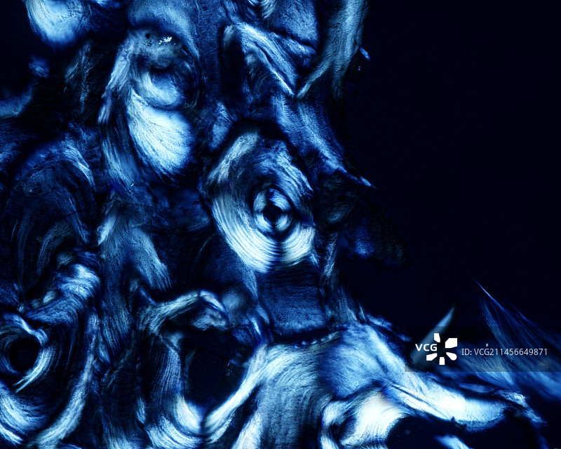 偏振光显微照片下的骨密质图片素材