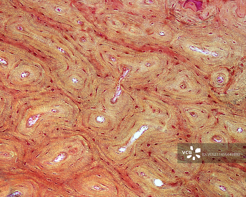 骨密质骨单位，光学显微照片图片素材
