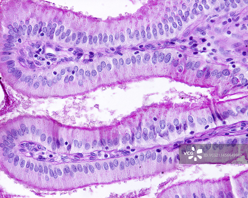 胆囊上皮细胞显微照片图片素材