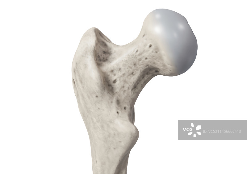 股骨颈和头部插图图片素材