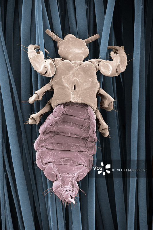 吸附在人发上的头虱图片素材