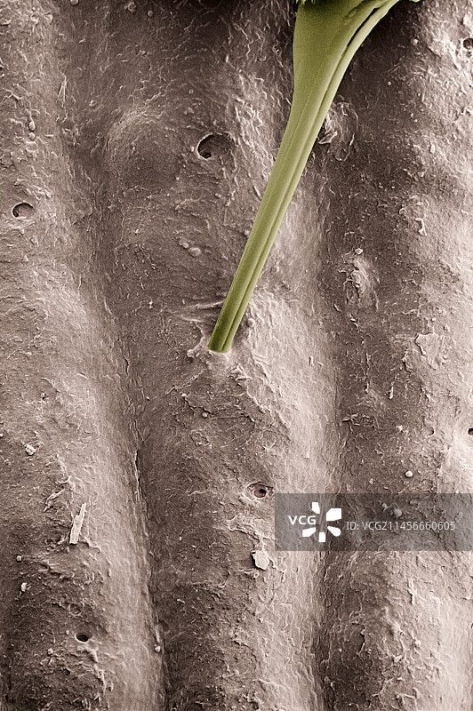 蜜蜂蛰人手指图片素材