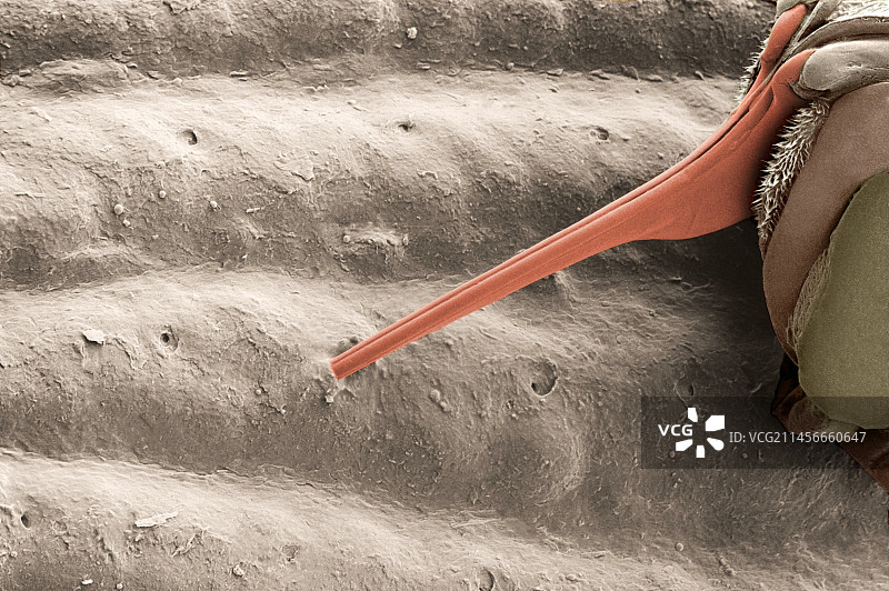 手指被蜜蜂蜇伤图片素材