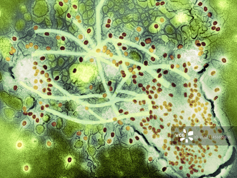因T4噬菌体感染引起的细菌裂解,TEM图片素材