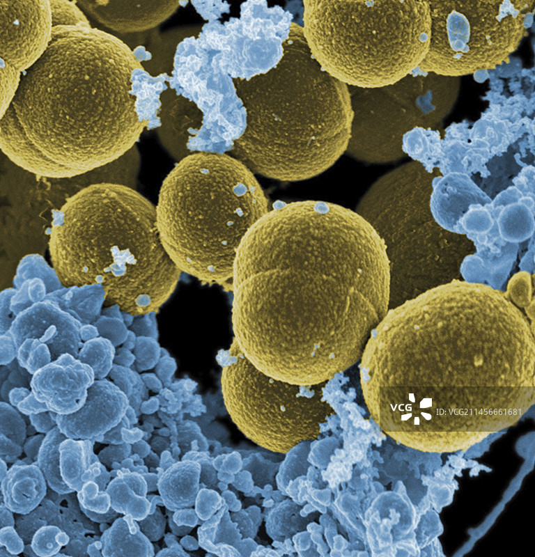 金黄色葡萄球菌和白细胞扫描电镜图图片素材