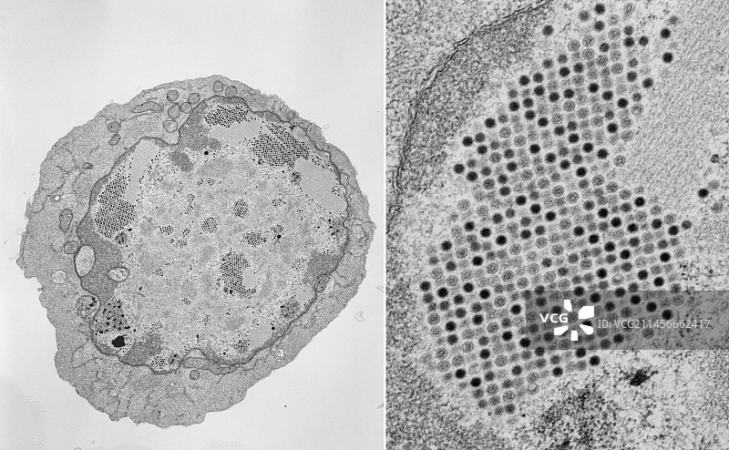 腺病毒透射电镜图图片素材