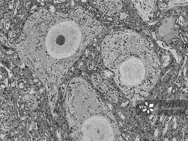 神经细胞，TEM图片素材