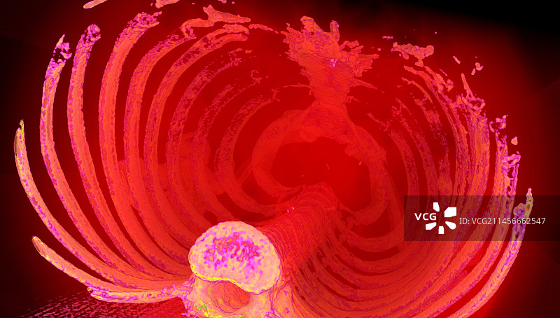 3D CT扫描肋骨图片素材