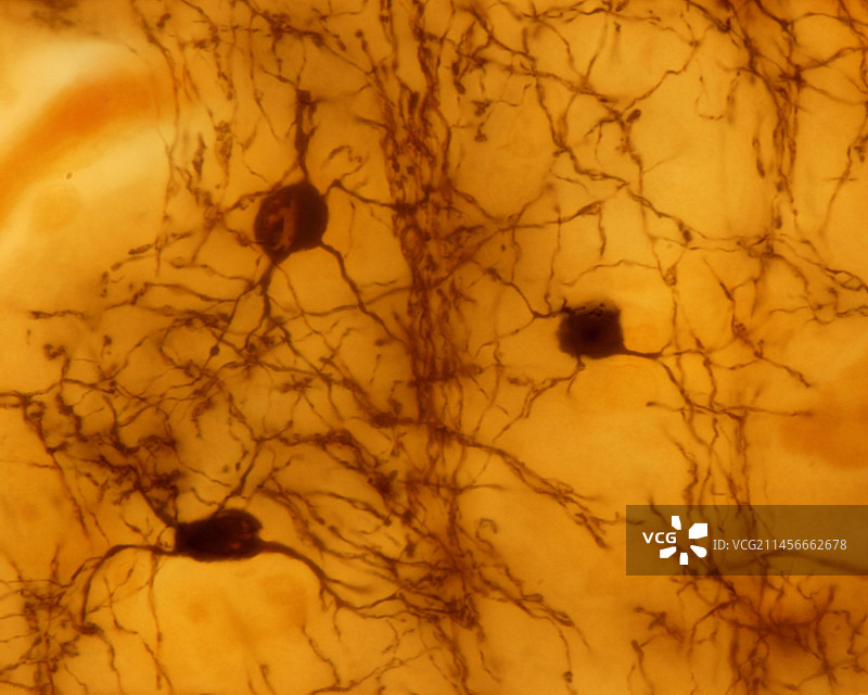 少突胶质细胞的光学显微照片图片素材