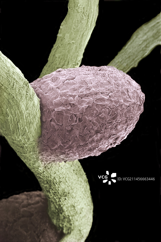 三叶草根瘤菌根瘤，扫描电镜图片素材