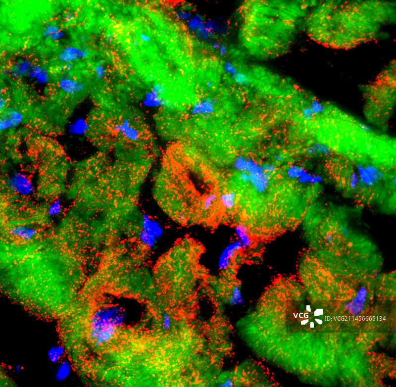 心肌荧光显微照片图片素材