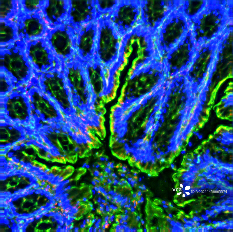 结肠中的白细胞光学显微照片图片素材