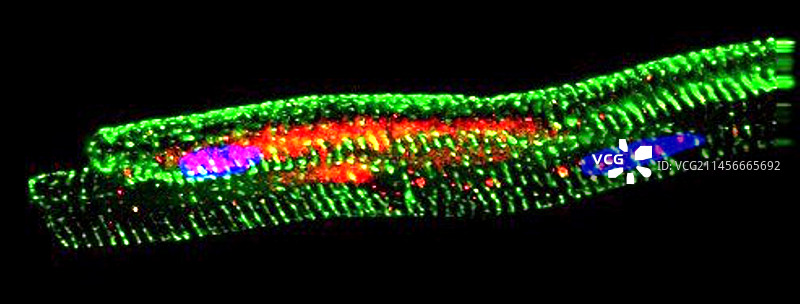 心肌转录因子显微照片图片素材
