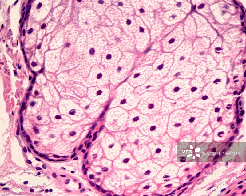 皮脂腺显微照片图片素材