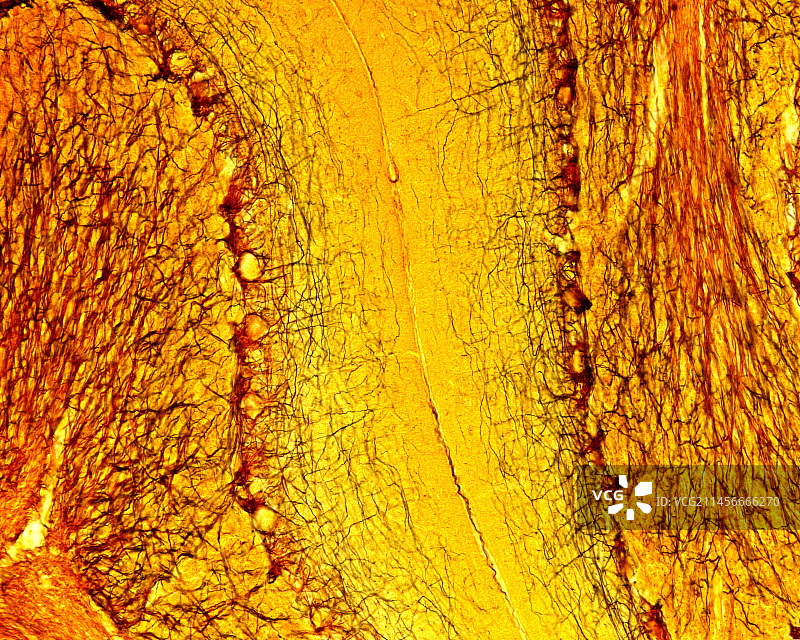 小脑皮层显微照片图片素材
