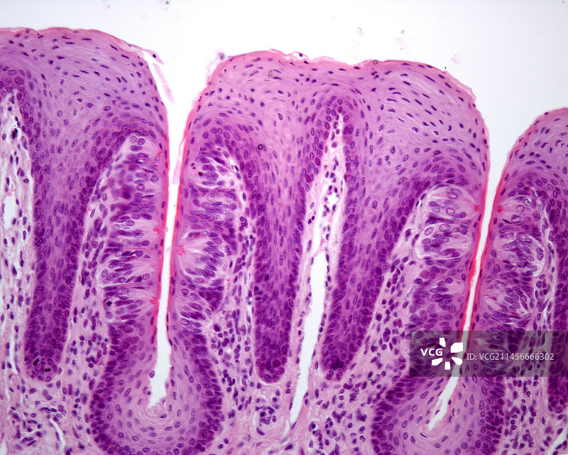 带有味蕾的叶状乳突，显微照片图片素材