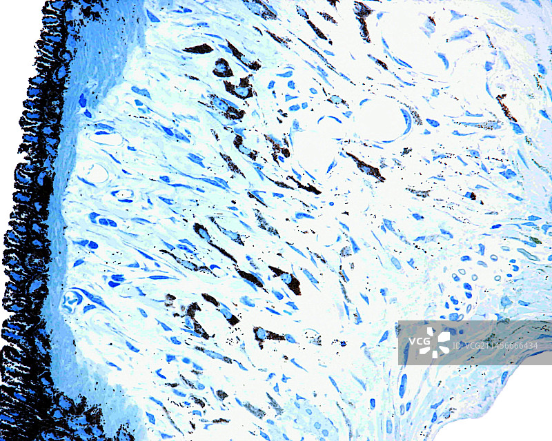 鸢尾花，光学显微照片图片素材