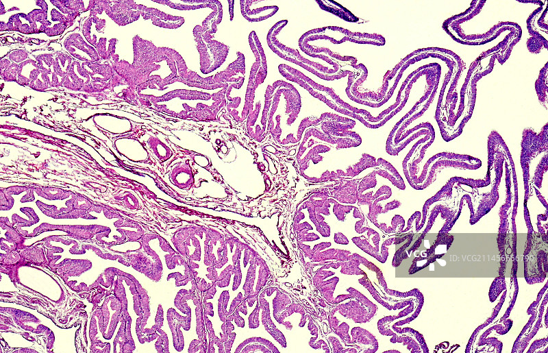 输卵管壶腹显微照片图片素材