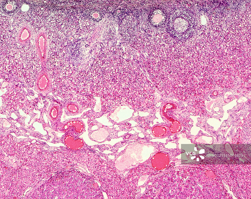 卵巢切片和黄体显微照片图片素材