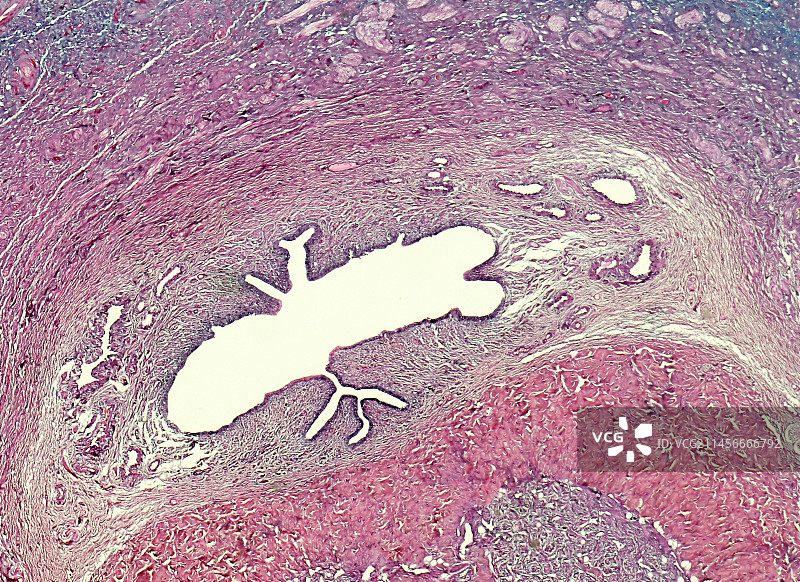 阴茎切片显微照片图片素材