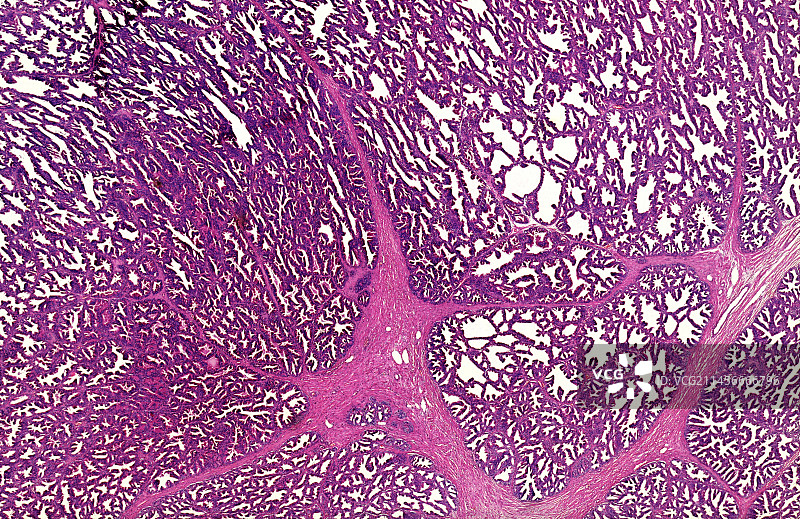 人前列腺切片显微照片图片素材
