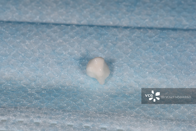 从儿童鼻子里取出的异物图片素材