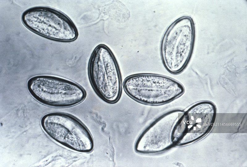 人蛲虫寄生虫卵的光学显微照片图片素材