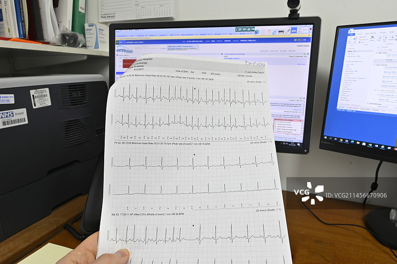 显示心动过速的心电图图片素材