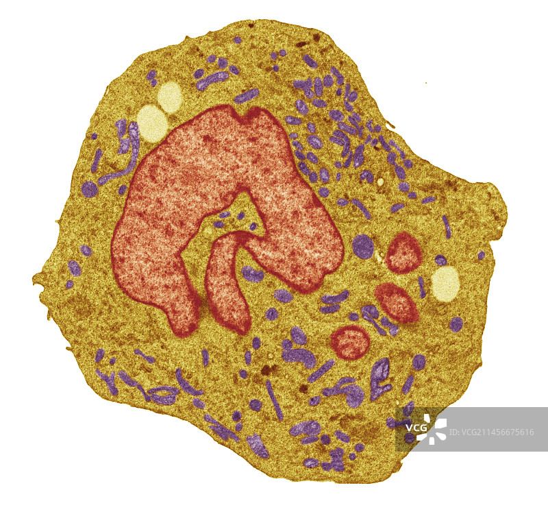 淋巴瘤癌细胞（透射电镜）图片素材