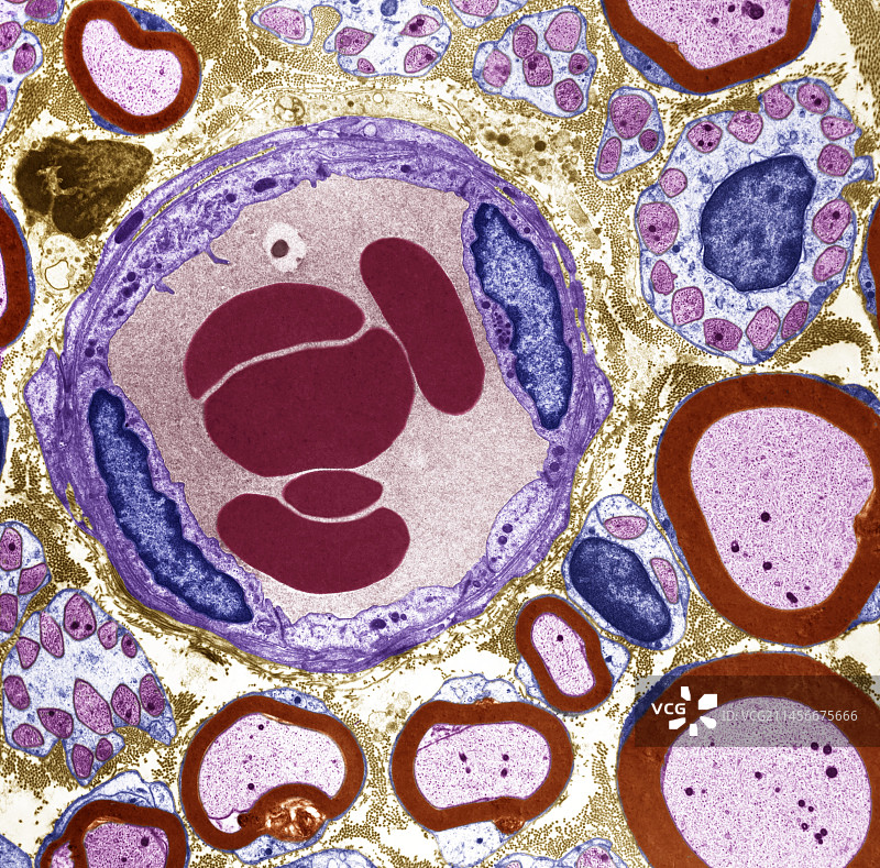 神经毛细血管，TEM图片素材