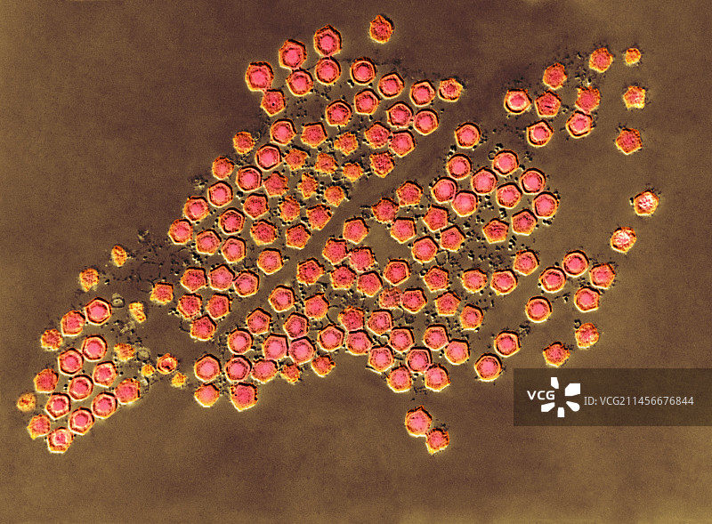 非洲猪瘟病毒，TEM图片素材