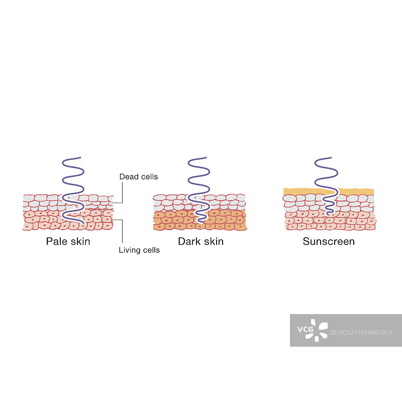 紫外线与皮肤，图示图片素材