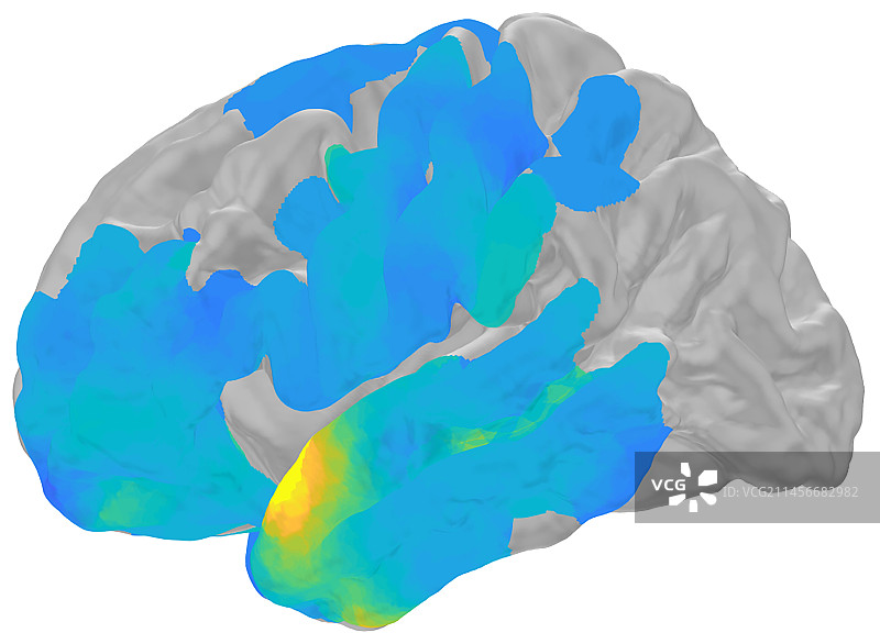 记忆提取的脑电波图示图片素材