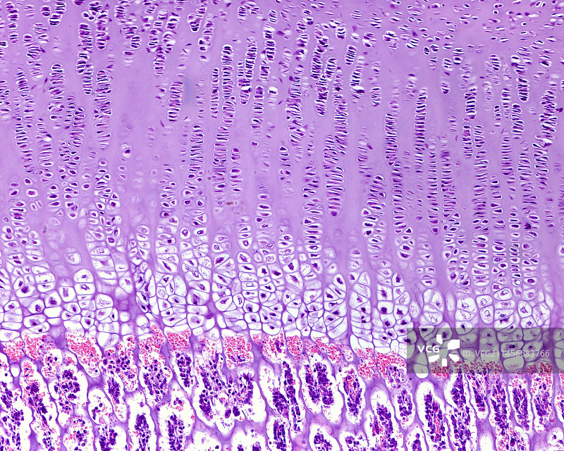 软骨内骨化，光学显微照片图片素材