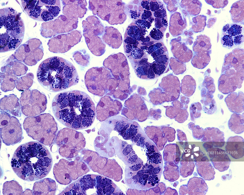颗粒状纹状导管显微照片图片素材