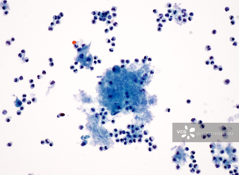 尿液中的细菌，光学显微照片图片素材