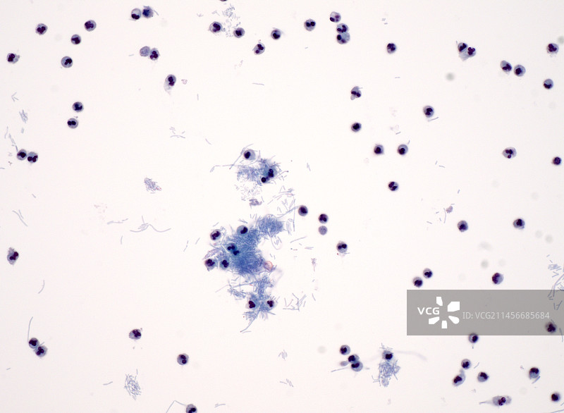 尿液中的细菌，光学显微照片图片素材