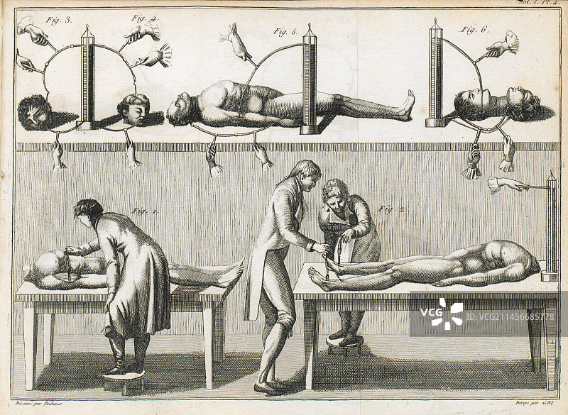 伽伐尼的尸体实验插图图片素材