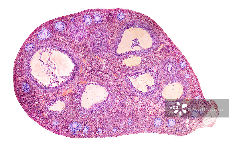 卵巢，LM图片素材