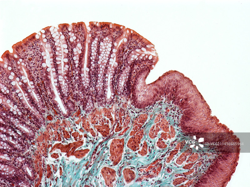 肛直肠交界处，LM图片素材