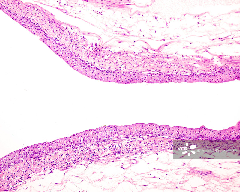 肾盂，光学显微镜照片图片素材