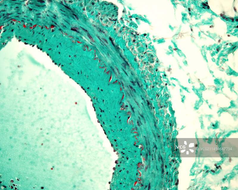 增厚的肌动脉，光学显微照片图片素材