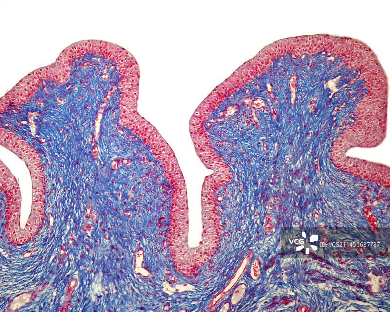 膀胱黏膜显微照片图片素材