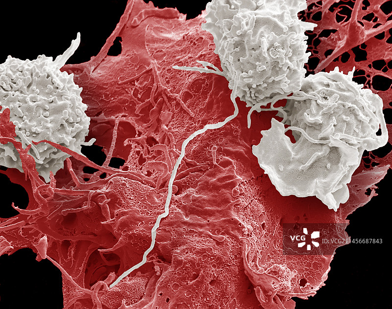 自然杀伤细胞与癌细胞，扫描电子显微镜图片素材